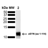 Western Blot - Anti-alpha Synuclein Antibody (A304963) - Antibodies.com