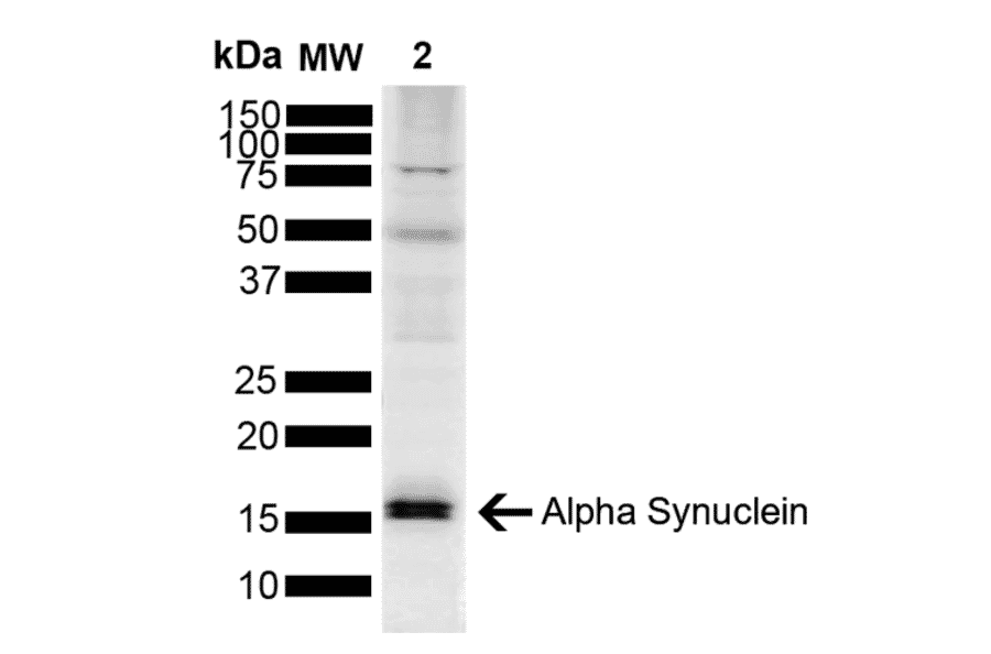 Western Blot - Anti-alpha Synuclein Antibody (A304963) - Antibodies.com