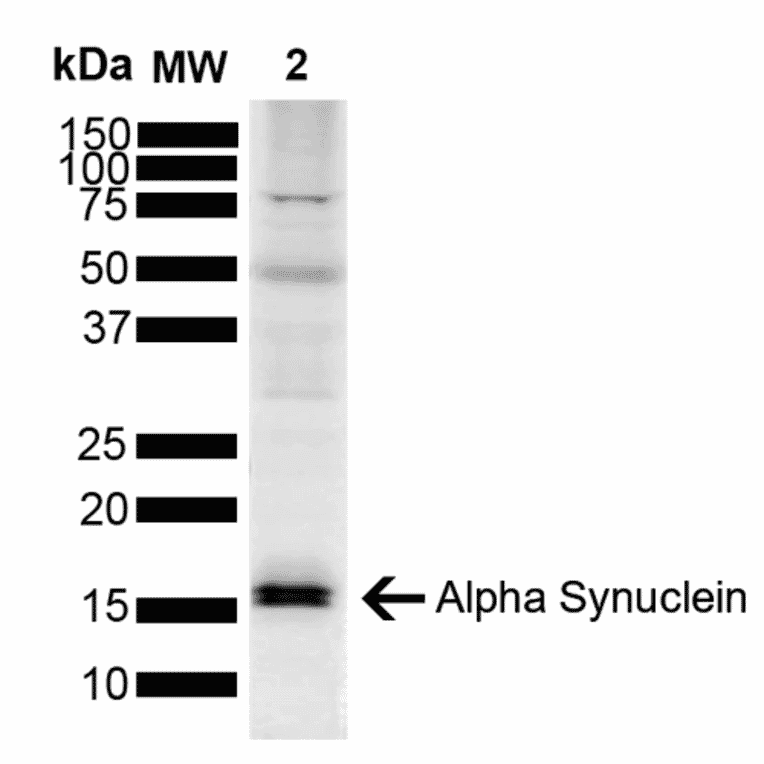 Western Blot - Anti-alpha Synuclein Antibody (A304963) - Antibodies.com