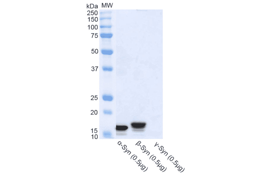 Western Blot - Anti-alpha Synuclein Antibody (A304963) - Antibodies.com