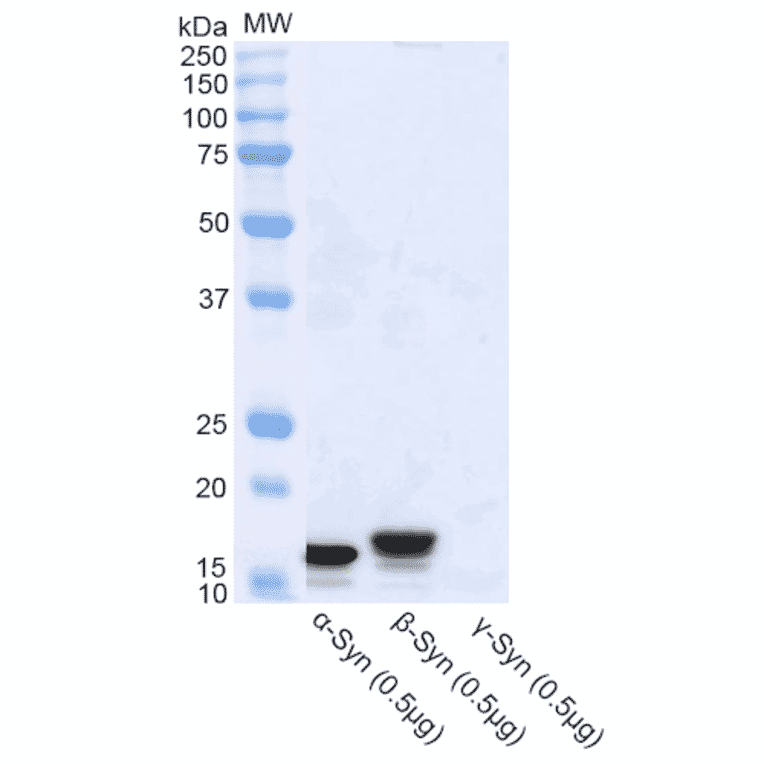 Western Blot - Anti-alpha Synuclein Antibody (A304963) - Antibodies.com