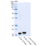 Western Blot - Anti-alpha Synuclein Antibody (A304963) - Antibodies.com