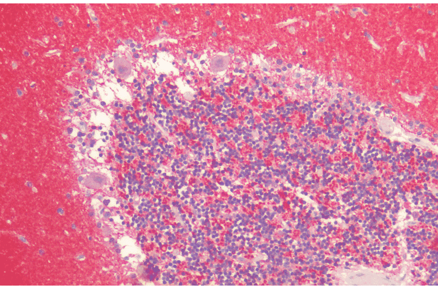 Immunohistochemistry - Anti-alpha Synuclein Antibody (A304963) - Antibodies.com