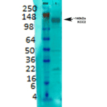 Western Blot - Anti-KCC2 Antibody [S1-12] (A304964) - Antibodies.com