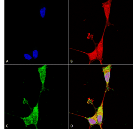 Immunocytochemistry/Immunofluorescence - Anti-Brevican Antibody [S294A-6] (A304965) - Antibodies.com