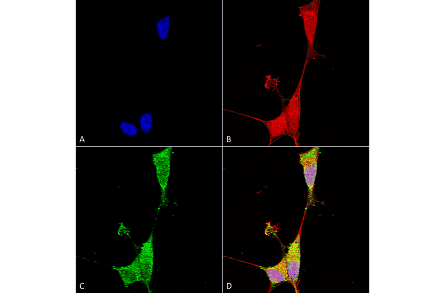 Immunocytochemistry/Immunofluorescence - Anti-Brevican Antibody [S294A-6] (A304965) - Antibodies.com