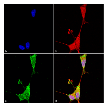 Immunocytochemistry/Immunofluorescence - Anti-Brevican Antibody [S294A-6] (A304965) - Antibodies.com