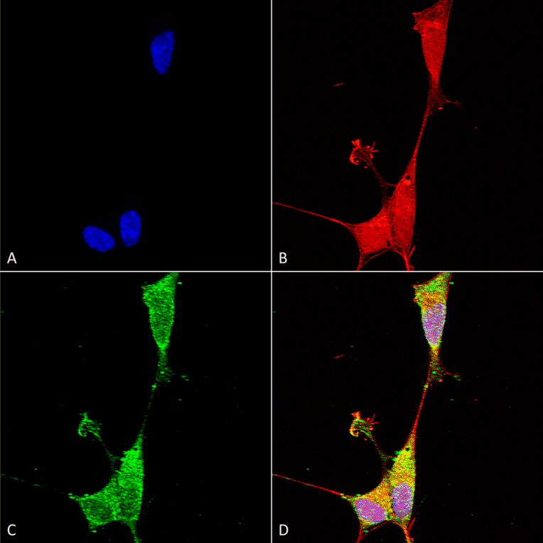 Immunocytochemistry/Immunofluorescence - Anti-Brevican Antibody [S294A-6] (A304965) - Antibodies.com