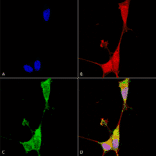 Immunocytochemistry/Immunofluorescence - Anti-Brevican Antibody [S294A-6] (A304965) - Antibodies.com