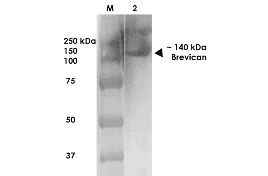 Western Blot - Anti-Brevican Antibody [S294A-6] (A304965) - Antibodies.com