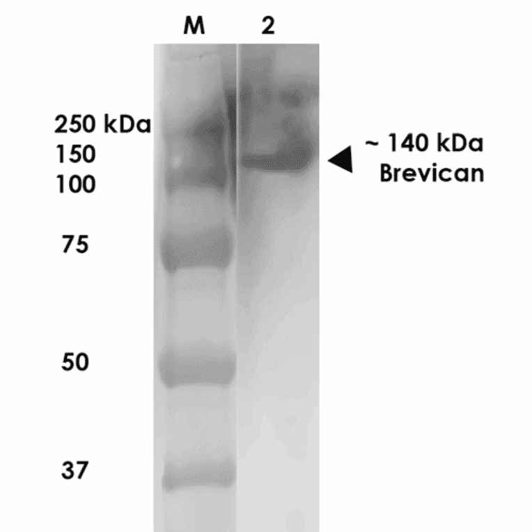 Western Blot - Anti-Brevican Antibody [S294A-6] (A304965) - Antibodies.com