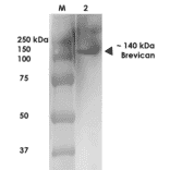 Western Blot - Anti-Brevican Antibody [S294A-6] (A304965) - Antibodies.com
