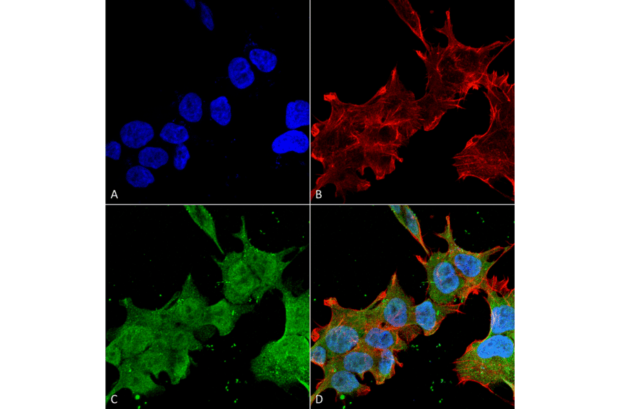 Immunocytochemistry/Immunofluorescence - Anti-Brevican Antibody [S294A-6] (A304965) - Antibodies.com