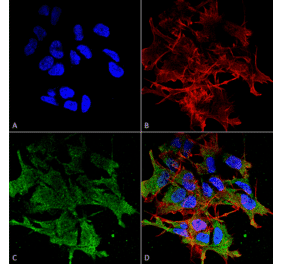 Immunocytochemistry/Immunofluorescence - Anti-SHANK2 Antibody [N23b/49] (A304967) - Antibodies.com