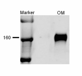 Western Blot - Anti-NKCC2 Antibody (A304968) - Antibodies.com