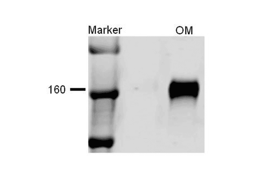 Western Blot - Anti-NKCC2 Antibody (A304968) - Antibodies.com
