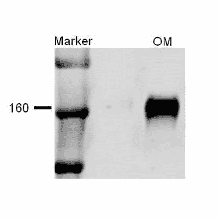 Western Blot - Anti-NKCC2 Antibody (A304968) - Antibodies.com