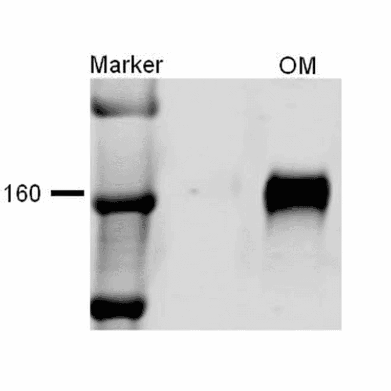 Western Blot - Anti-NKCC2 Antibody (A304968) - Antibodies.com
