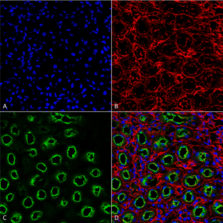 Immunohistochemistry - Anti-NKCC2 Antibody (A304968) - Antibodies.com
