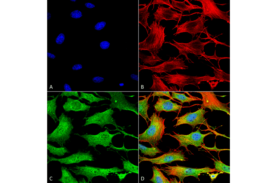 Immunocytochemistry/Immunofluorescence - Anti-ATP7B Antibody [S62-29] (A304969) - Antibodies.com