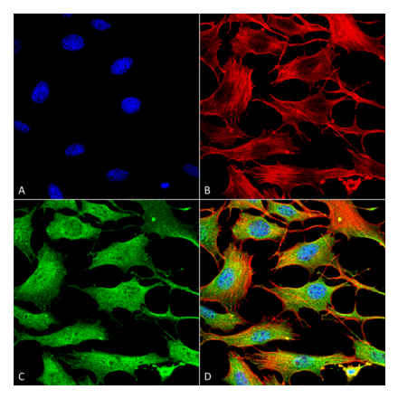 Immunocytochemistry/Immunofluorescence - Anti-ATP7B Antibody [S62-29] (A304969) - Antibodies.com