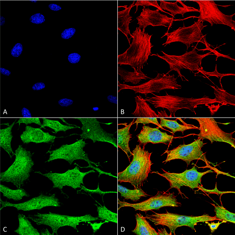 Immunocytochemistry/Immunofluorescence - Anti-ATP7B Antibody [S62-29] (A304969) - Antibodies.com