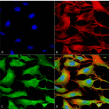 Immunocytochemistry/Immunofluorescence - Anti-ATP7B Antibody [S62-29] (A304969) - Antibodies.com
