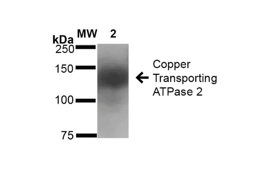 Western Blot - Anti-ATP7B Antibody [S62-29] (A304969) - Antibodies.com