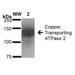 Western Blot - Anti-ATP7B Antibody [S62-29] (A304969) - Antibodies.com