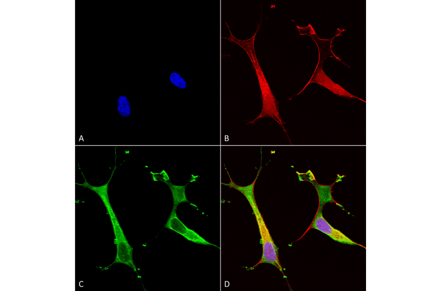 Immunocytochemistry/Immunofluorescence - Anti-ATP7B Antibody [S62-29] (A304969) - Antibodies.com