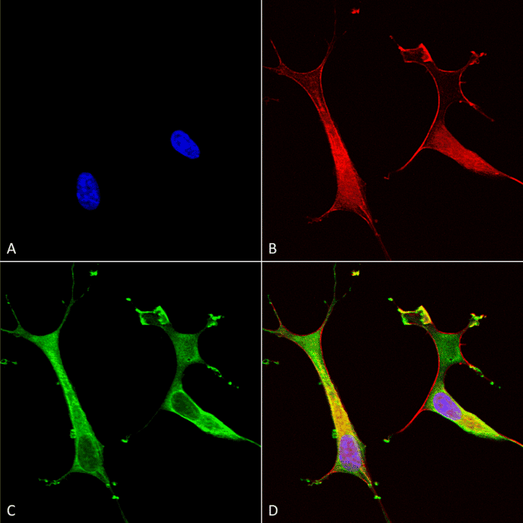 Immunocytochemistry/Immunofluorescence - Anti-ATP7B Antibody [S62-29] (A304969) - Antibodies.com