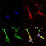 Immunocytochemistry/Immunofluorescence - Anti-ATP7B Antibody [S62-29] (A304969) - Antibodies.com