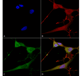 Immunocytochemistry/Immunofluorescence - Anti-NrCAM Antibody [S364-51] (A304970) - Antibodies.com