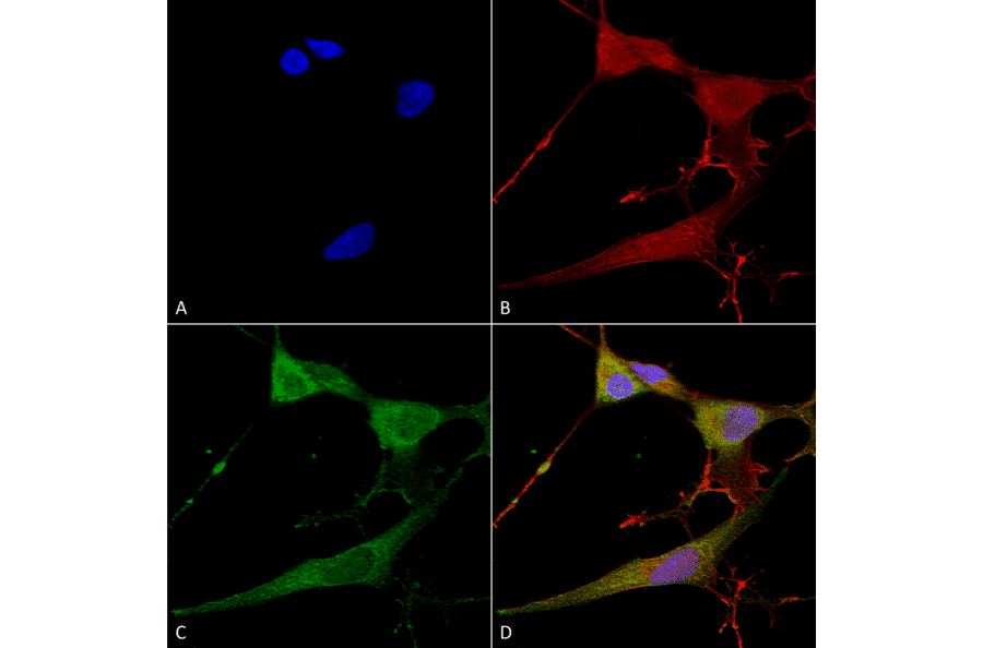Immunocytochemistry/Immunofluorescence - Anti-NrCAM Antibody [S364-51] (A304970) - Antibodies.com
