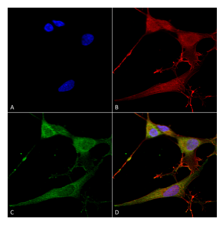 Immunocytochemistry/Immunofluorescence - Anti-NrCAM Antibody [S364-51] (A304970) - Antibodies.com