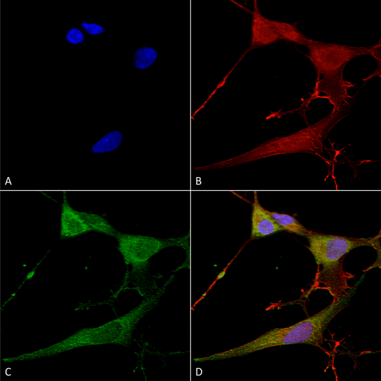 Immunocytochemistry/Immunofluorescence - Anti-NrCAM Antibody [S364-51] (A304970) - Antibodies.com