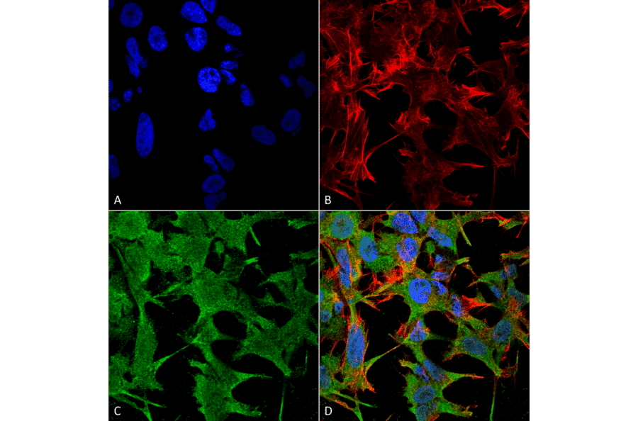 Immunocytochemistry/Immunofluorescence - Anti-NrCAM Antibody [S364-51] (A304970) - Antibodies.com
