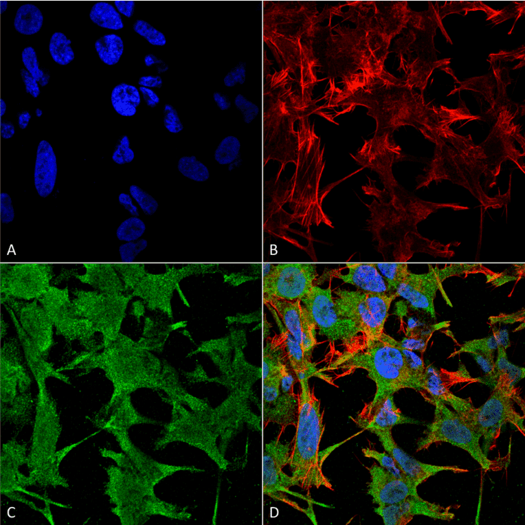 Immunocytochemistry/Immunofluorescence - Anti-NrCAM Antibody [S364-51] (A304970) - Antibodies.com