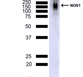 Western Blot - Anti-NOS1 Antibody [J23] (A304971) - Antibodies.com