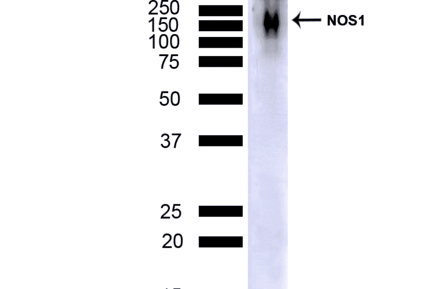 Western Blot - Anti-NOS1 Antibody [J23] (A304971) - Antibodies.com