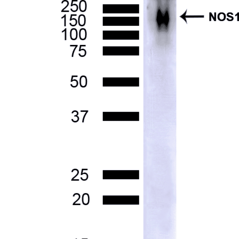 Western Blot - Anti-NOS1 Antibody [J23] (A304971) - Antibodies.com