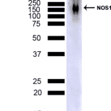 Western Blot - Anti-NOS1 Antibody [J23] (A304971) - Antibodies.com