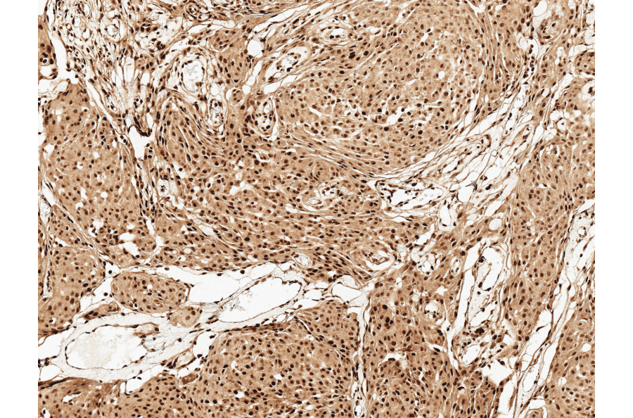 Immunohistochemistry - Anti-FUNDC1 Antibody (A304972) - Antibodies.com