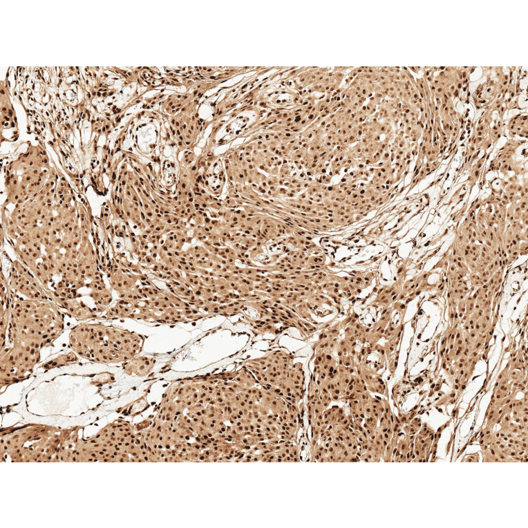 Immunohistochemistry - Anti-FUNDC1 Antibody (A304972) - Antibodies.com