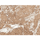 Immunohistochemistry - Anti-FUNDC1 Antibody (A304972) - Antibodies.com