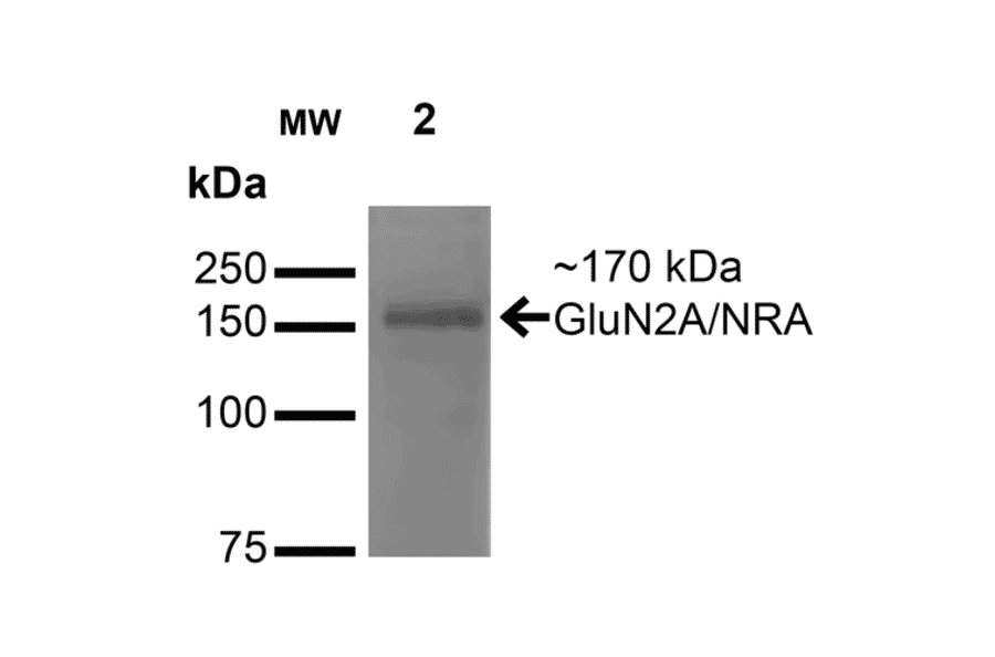 Western Blot - Anti-NMDAR2A Antibody [S327-95] (A304974) - Antibodies.com