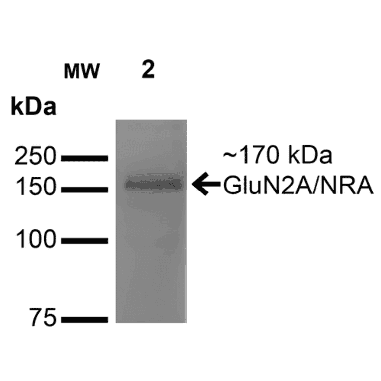 Western Blot - Anti-NMDAR2A Antibody [S327-95] (A304974) - Antibodies.com