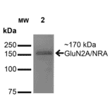 Western Blot - Anti-NMDAR2A Antibody [S327-95] (A304974) - Antibodies.com