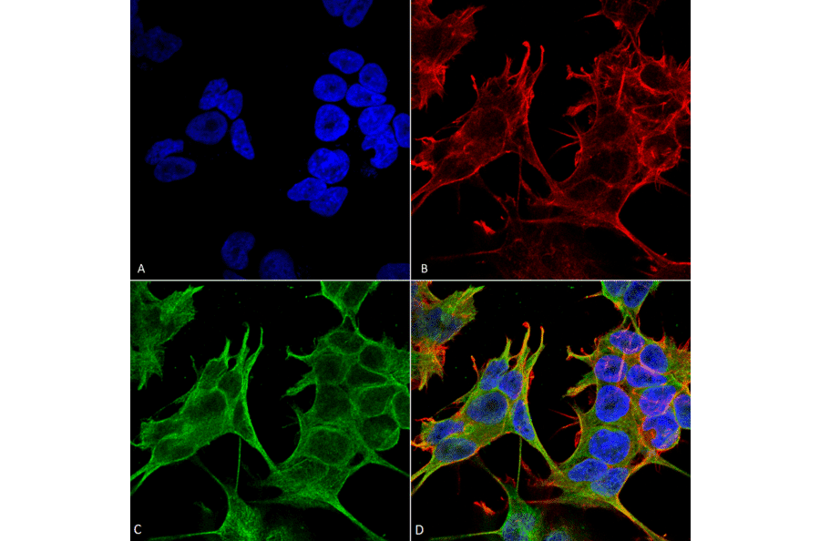 Immunocytochemistry/Immunofluorescence - Anti-NMDAR2A Antibody [S327-95] (A304974) - Antibodies.com