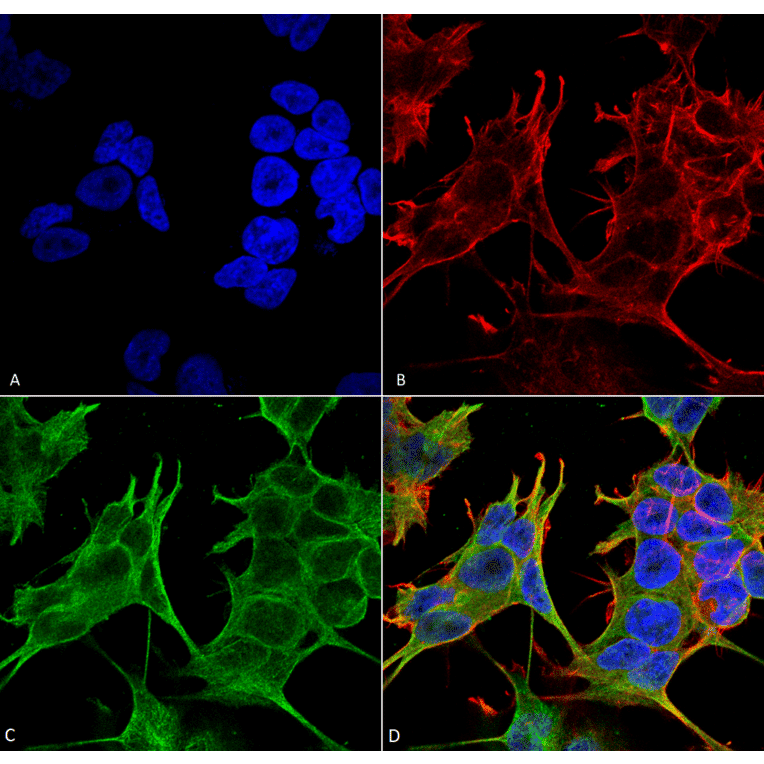 Immunocytochemistry/Immunofluorescence - Anti-NMDAR2A Antibody [S327-95] (A304974) - Antibodies.com